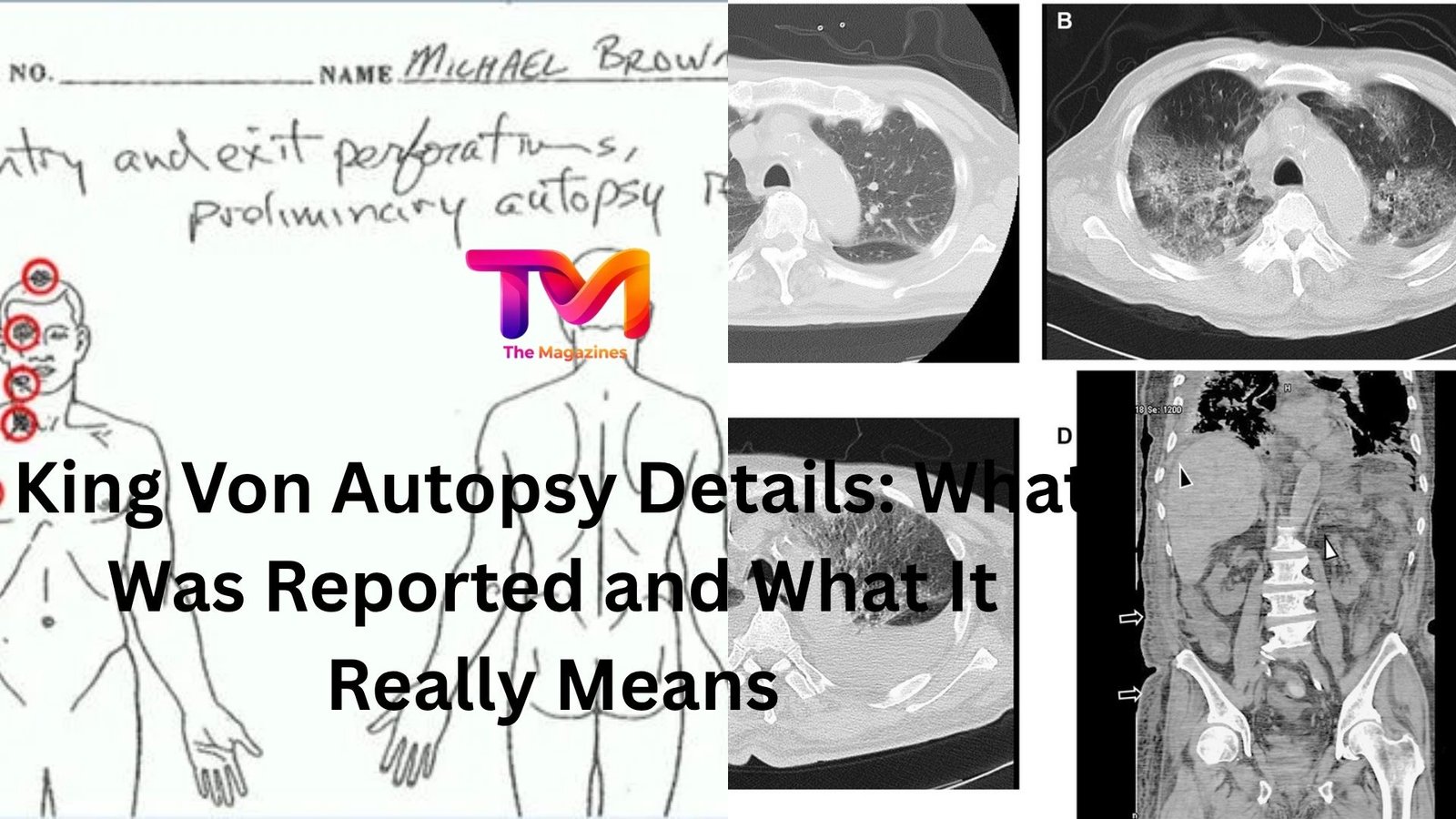 king von autopsy details